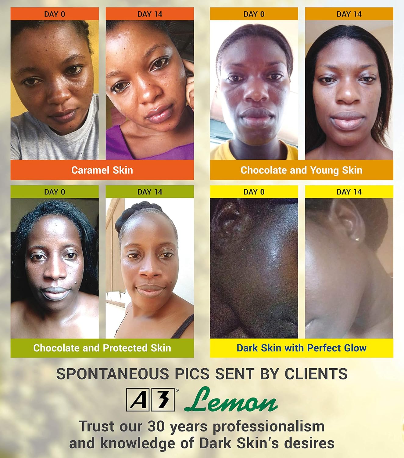 A3 4-Ever Bright Lemon Body Moisturizer β 400ml - Image 3